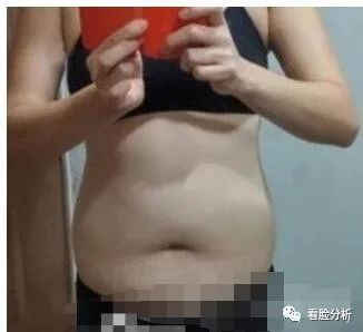 案例图片