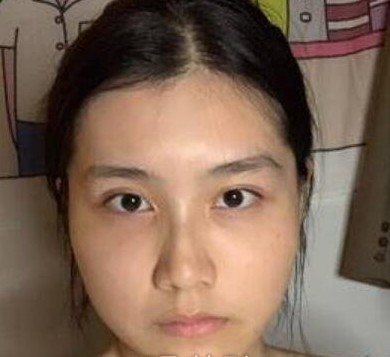 案例图片