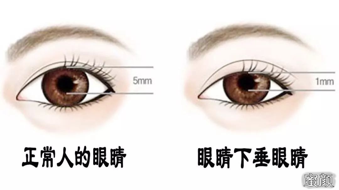 案例图片