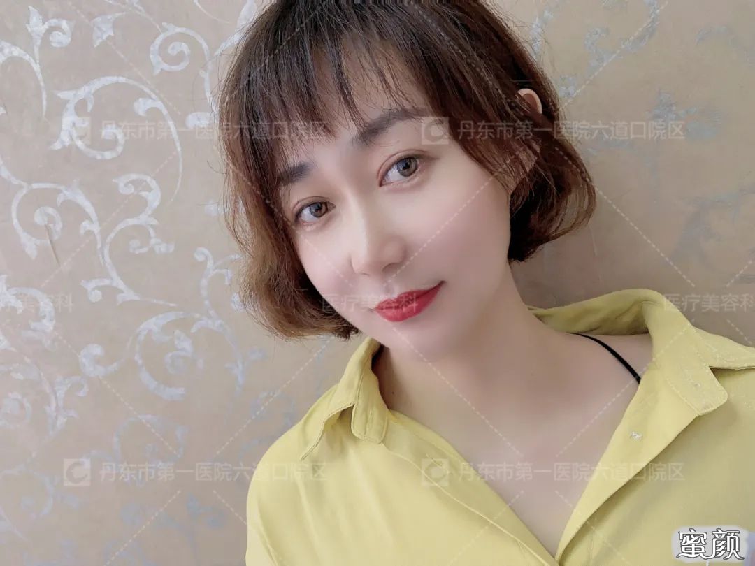 https://img.yiyiaimei.com/mnt/timg/200829/1025535R3-7.jpg 案例图片