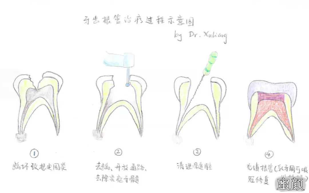 案例图片