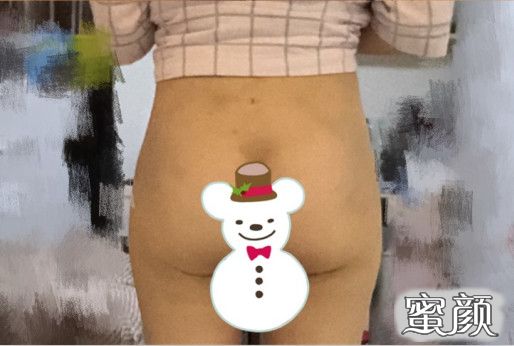 案例图片