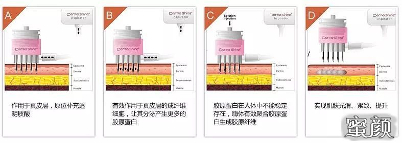 https://img.yiyiaimei.com/mnt/timg/200829/1305004506-2.jpg