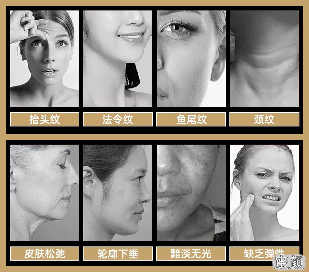 https://img.yiyiaimei.com/mnt/timg/200829/130T33137-2.jpg