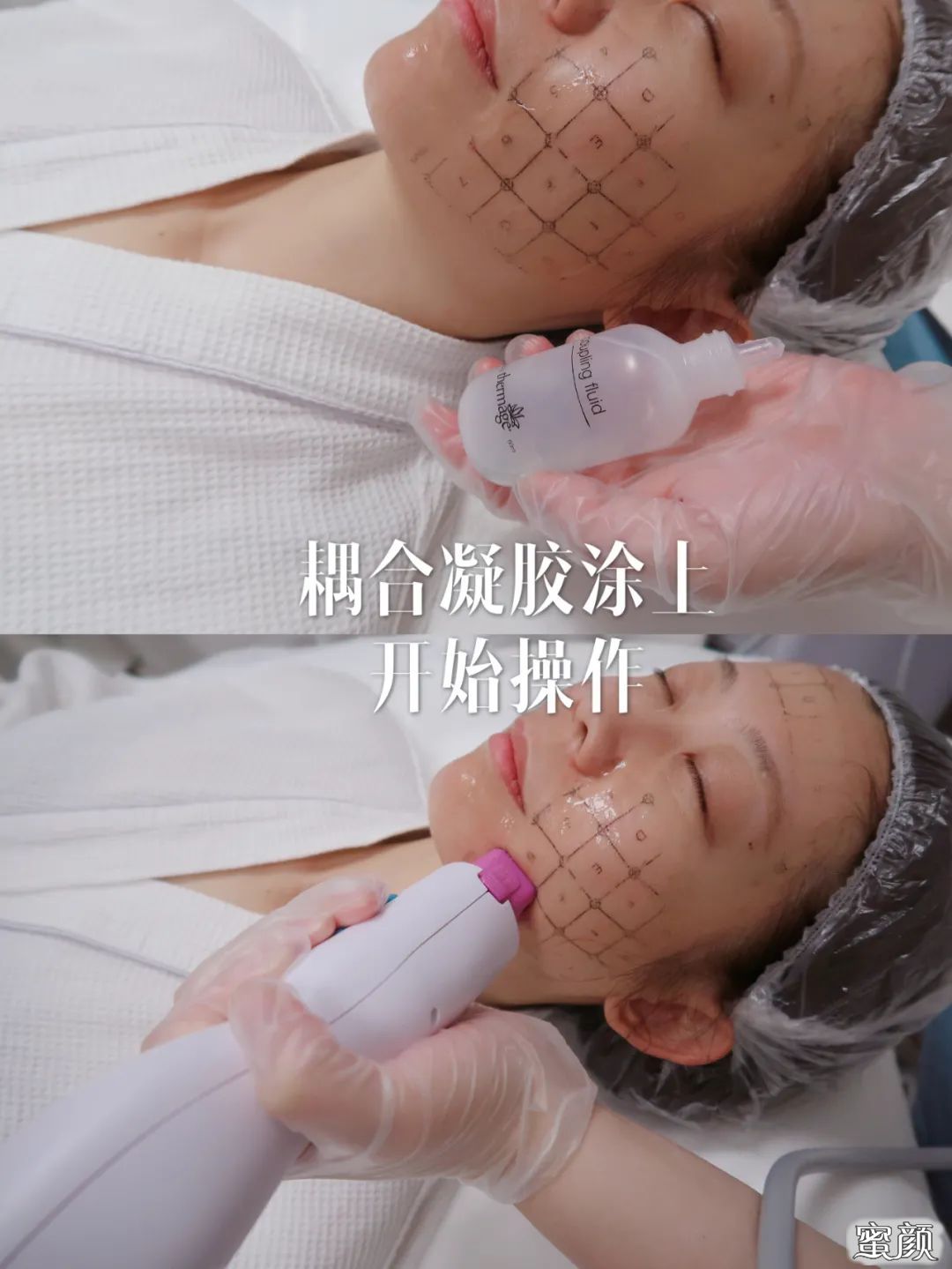 案例图片