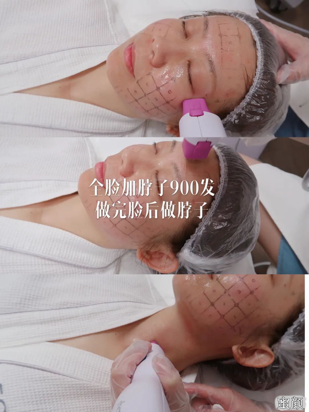 案例图片