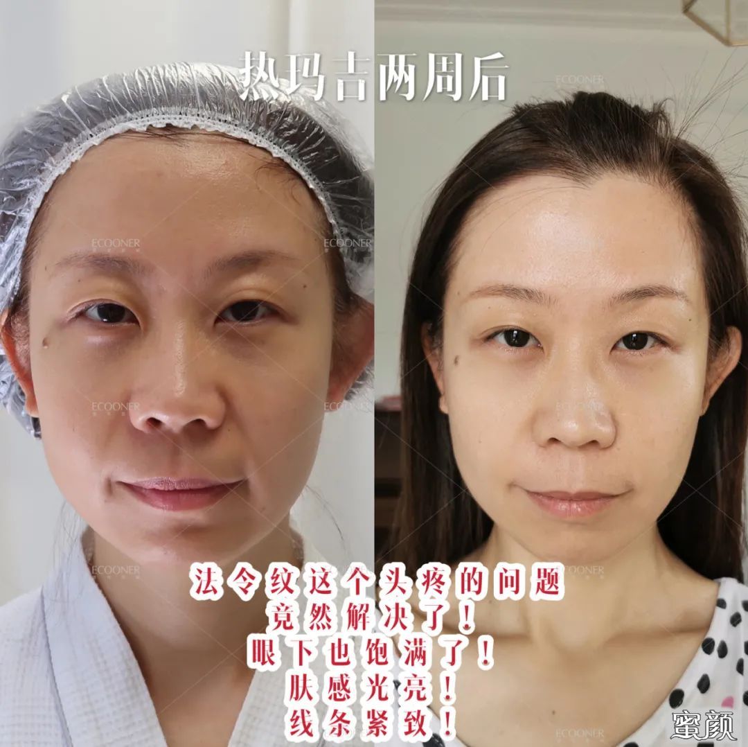 案例图片