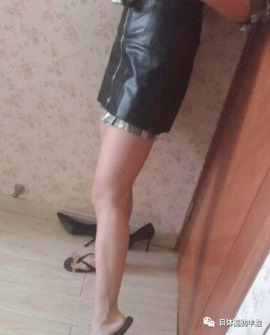案例图片