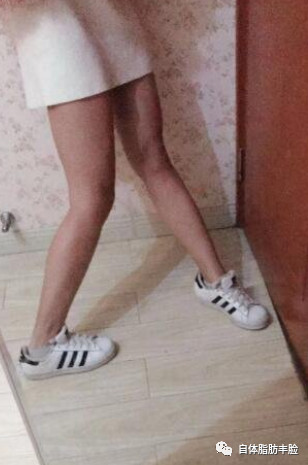 案例图片