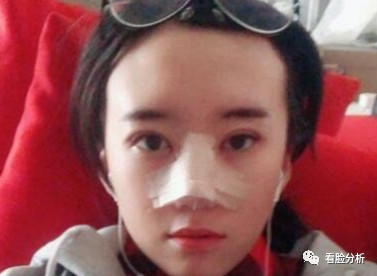 案例图片