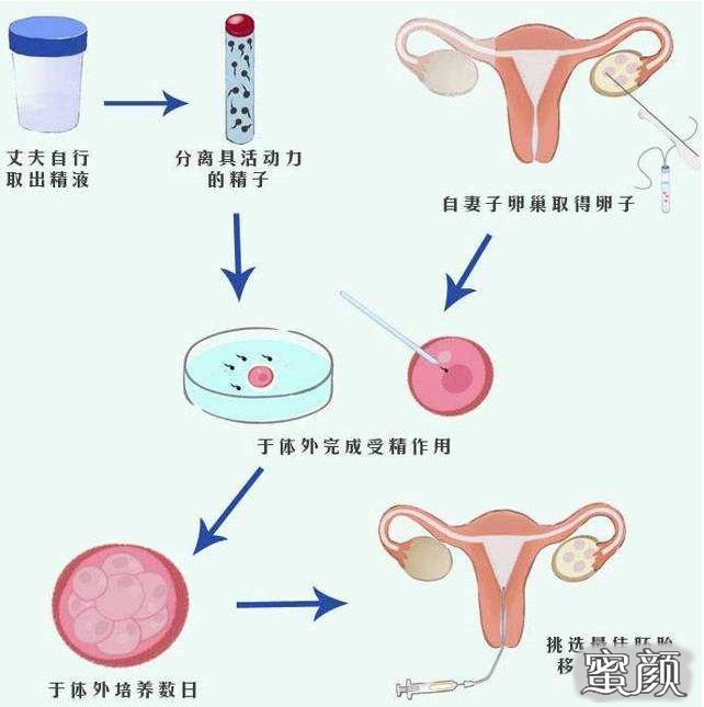https://img.yiyiaimei.com/mnt/timg/200829/134HBO7-0.jpg