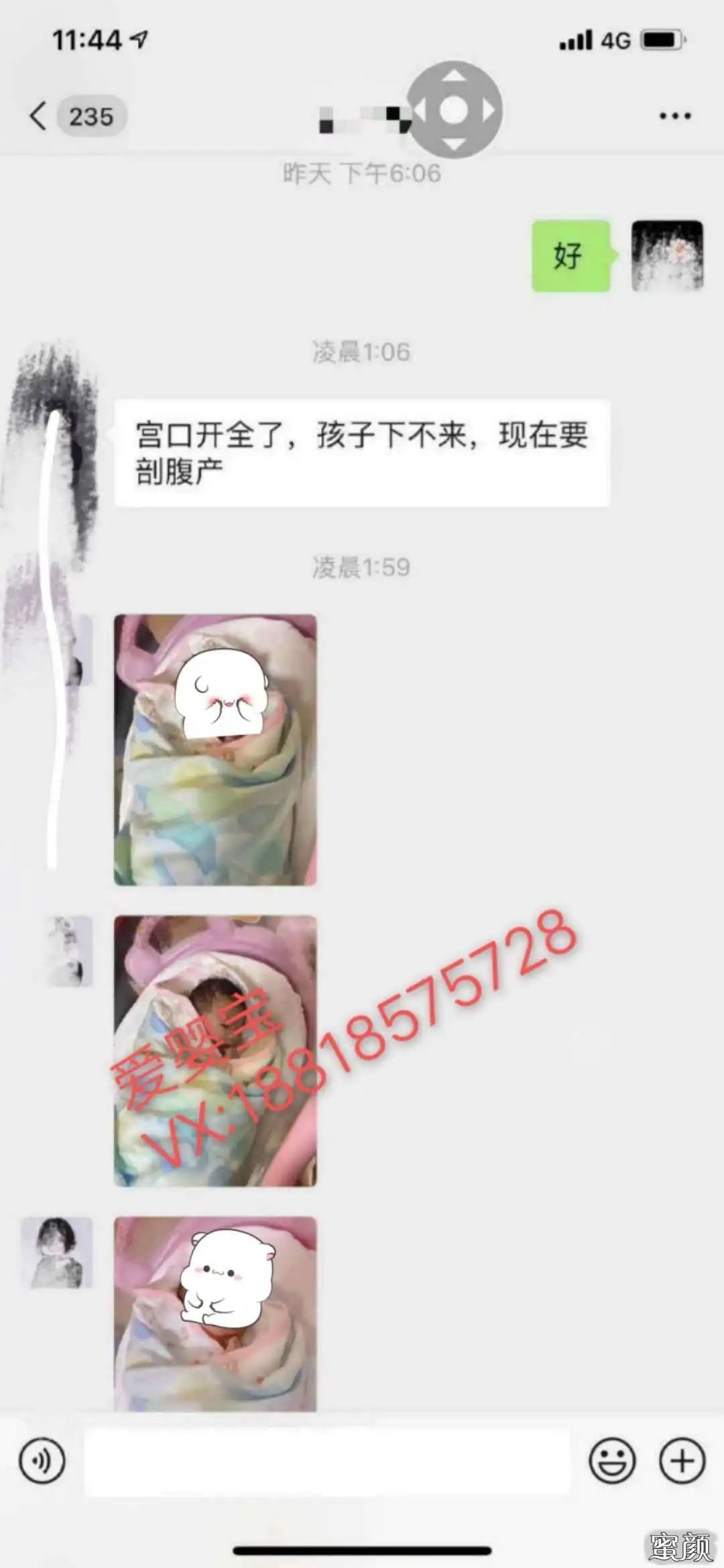 https://img.yiyiaimei.com/mnt/timg/200830/120S24G5-1.jpg 案例图片
