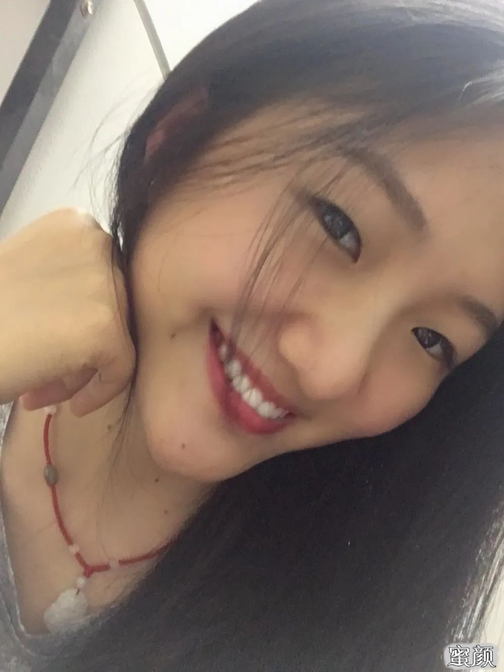 案例图片