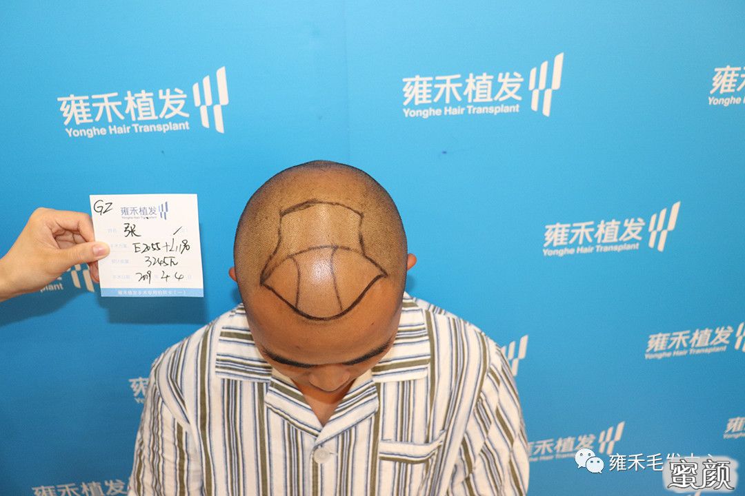 案例图片
