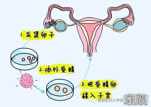 https://img.yiyiaimei.com/mnt/timg/200903/125940O56-0.jpg 案例图片