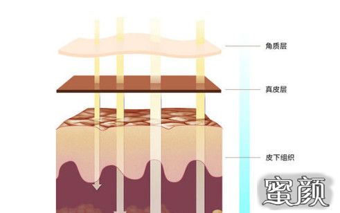 案例图片