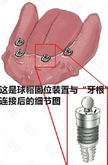 案例图片