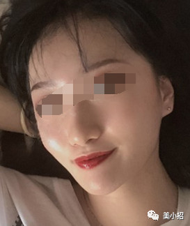 案例图片