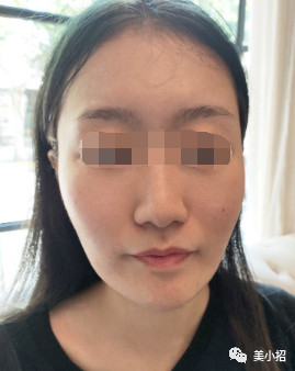 案例图片