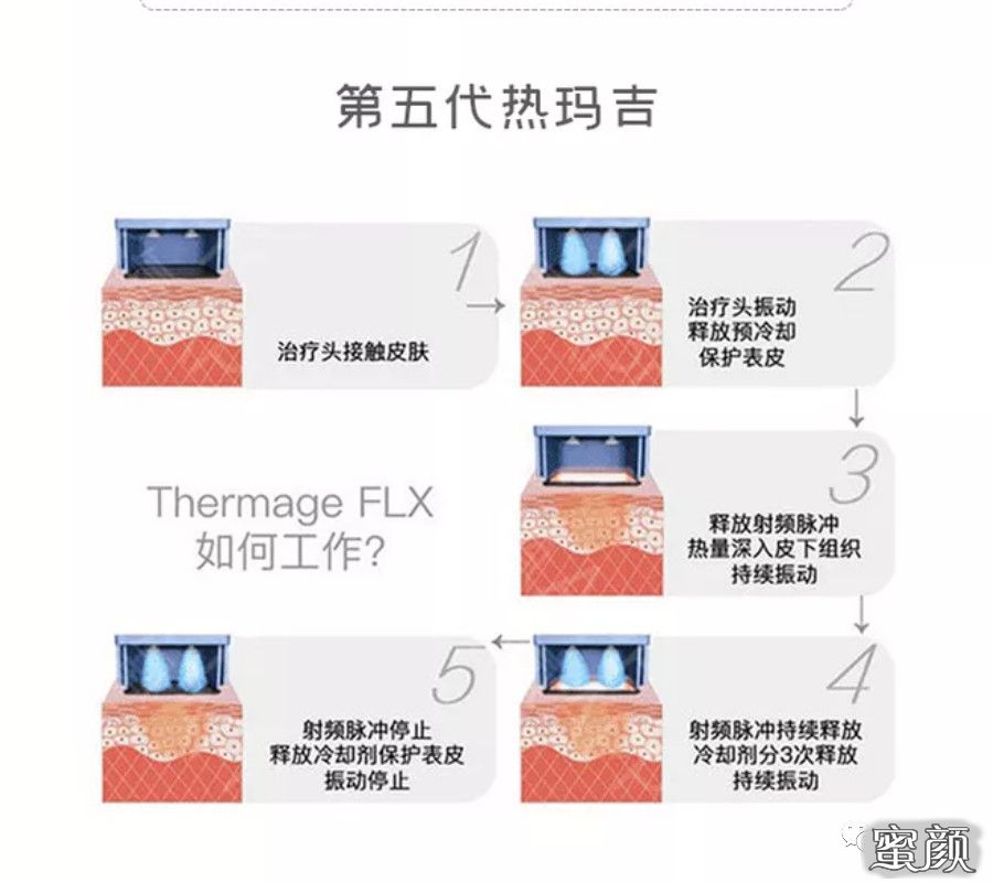 https://img.yiyiaimei.com/mnt/timg/200926/1355242062-1.jpg 案例图片