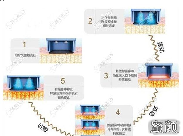 案例图片