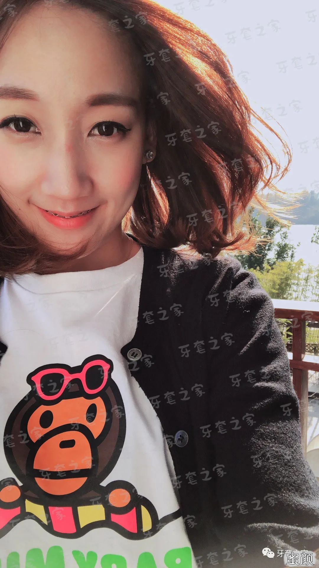 案例图片