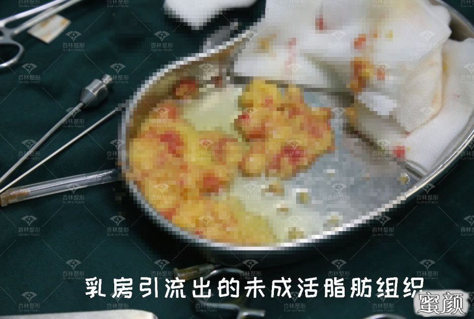 案例图片