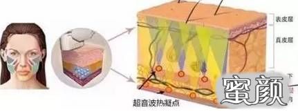 案例图片