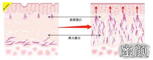 案例图片