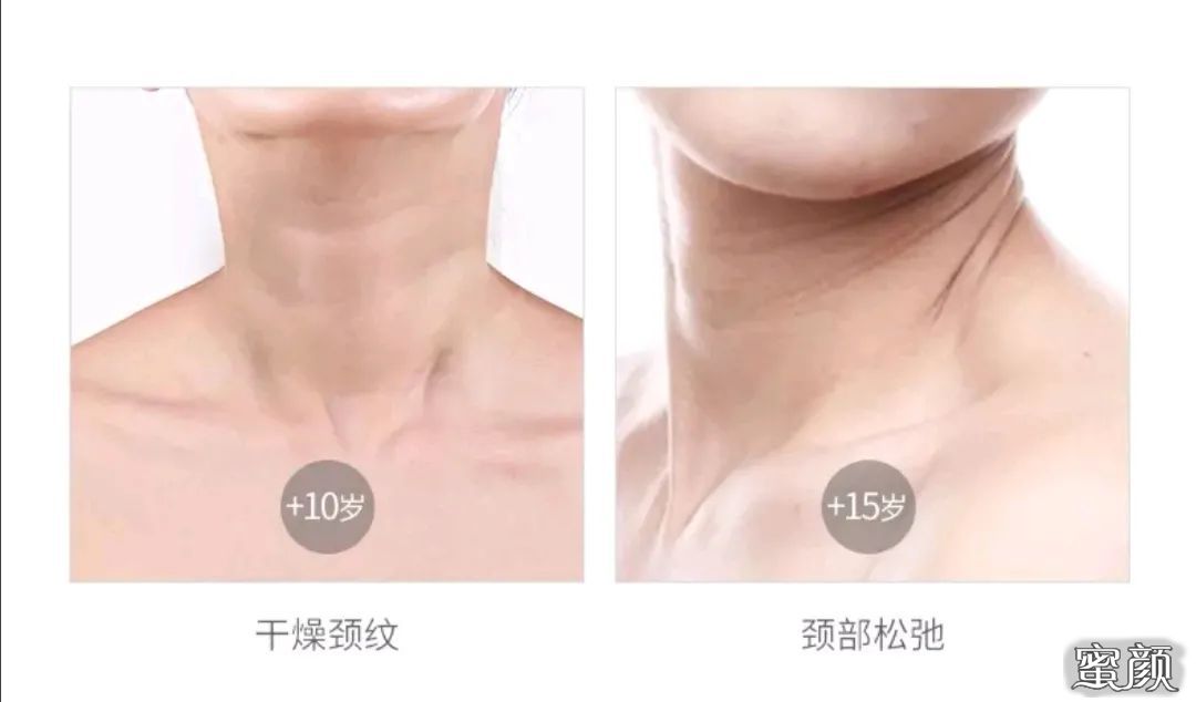案例图片