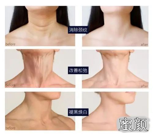 案例图片