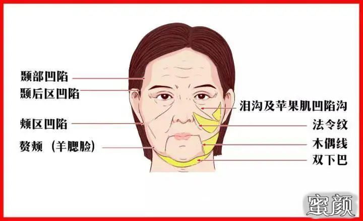 案例图片