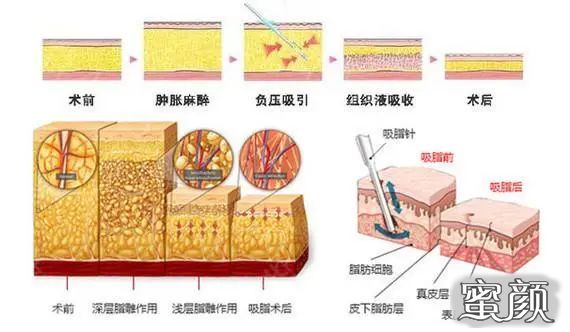 案例图片