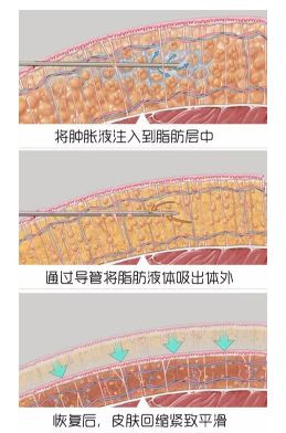 案例图片