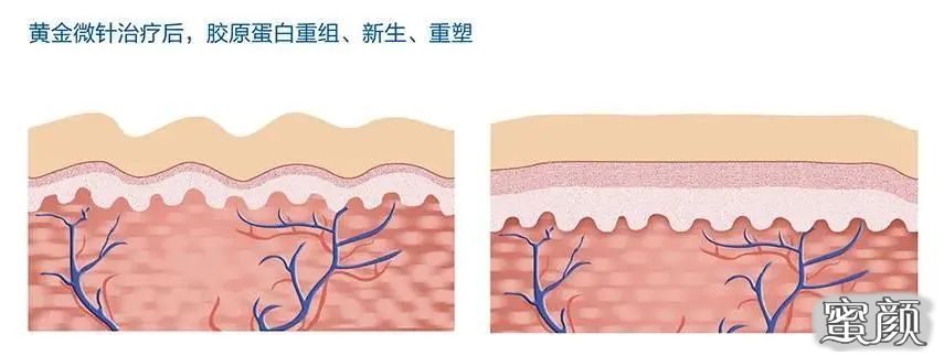 案例图片