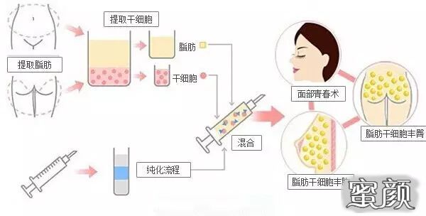 https://img.yiyiaimei.com/mnt/timg/201113/223S03323-2.jpg