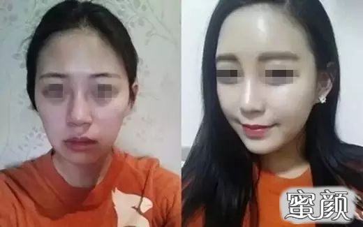 https://img.yiyiaimei.com/mnt/timg/201113/223S2Ea-7.jpg