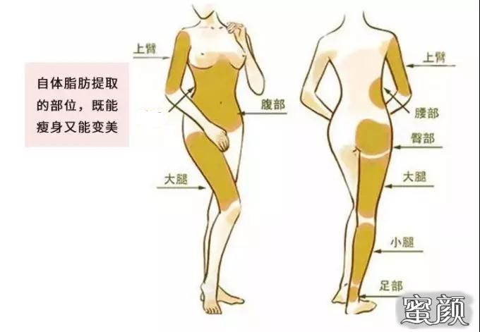 https://img.yiyiaimei.com/mnt/timg/201114/13394C208-5.jpg