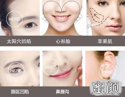 案例图片
