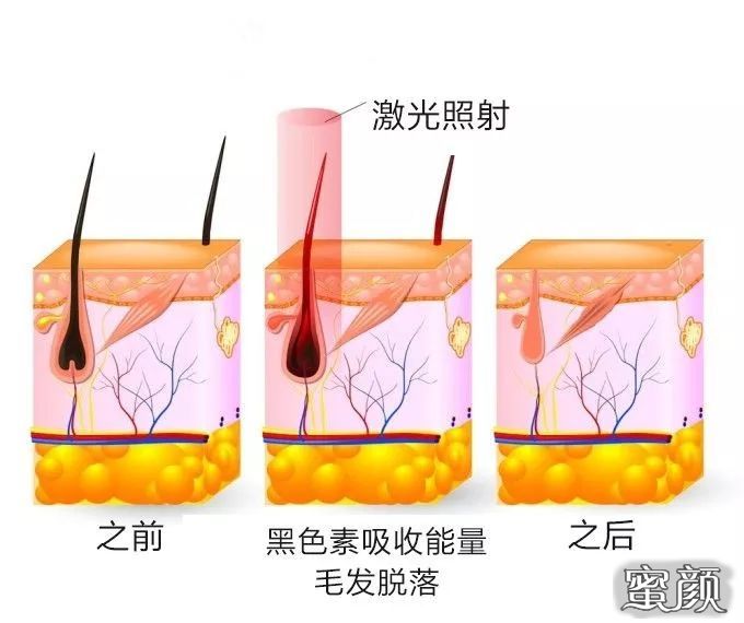 案例图片