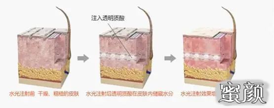 案例图片
