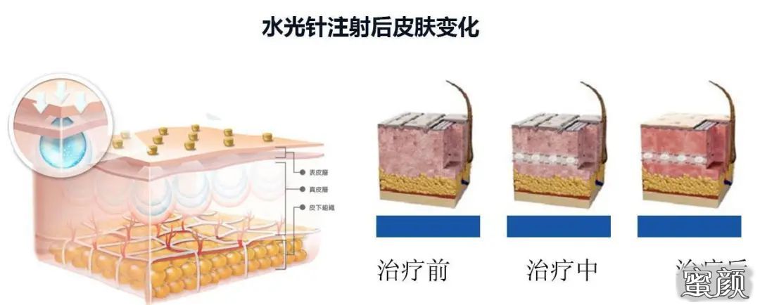 案例图片