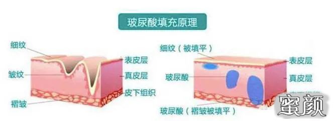 案例图片