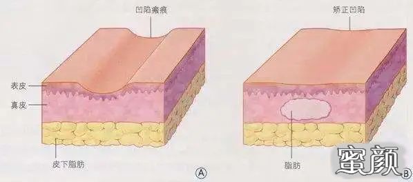 案例图片