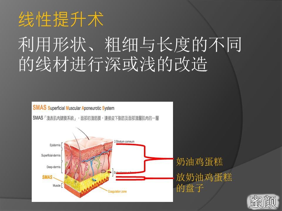 案例图片