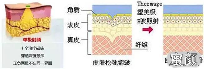 案例图片