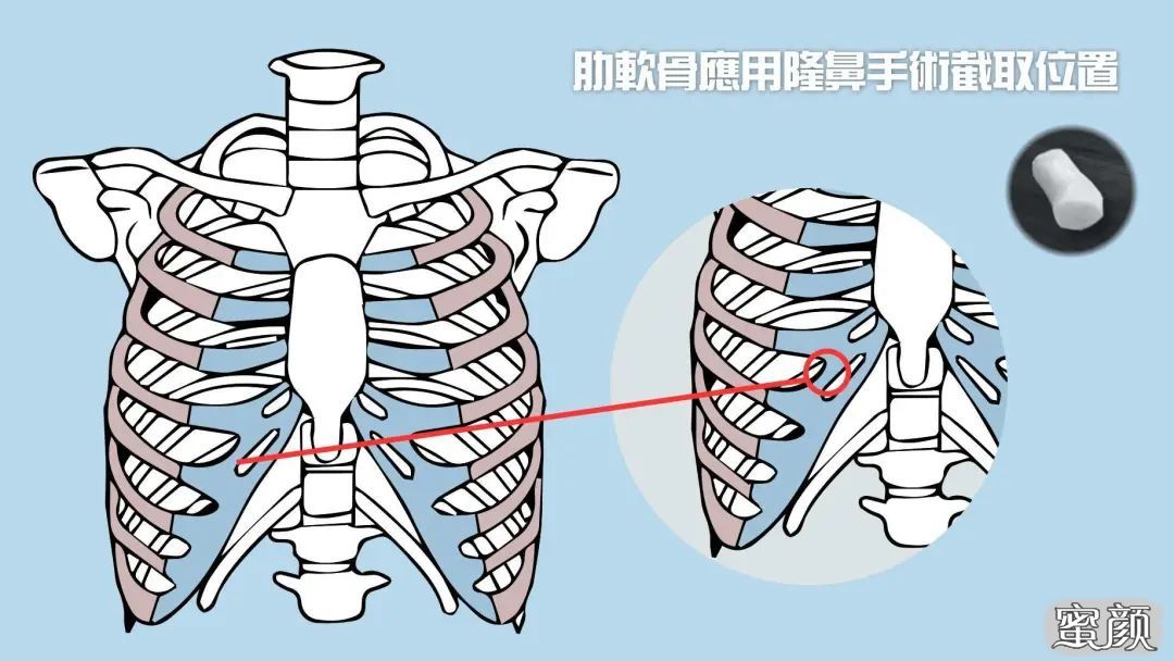 案例图片