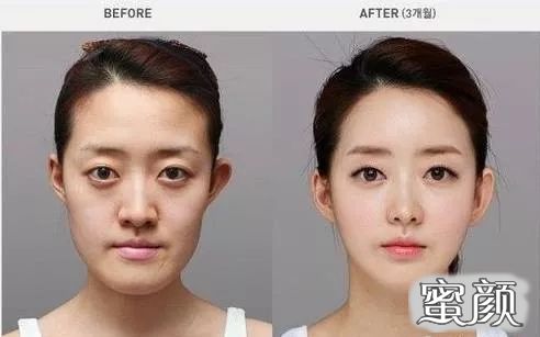 案例图片