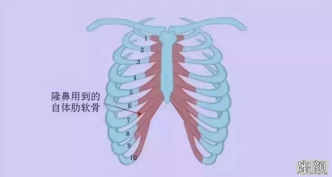 案例图片