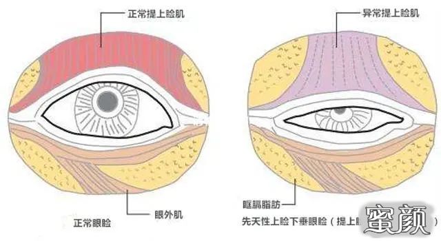 案例图片